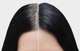 Reversing Gray Hair Serum