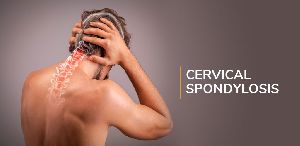 Cervical Spondylosis Treatment Services