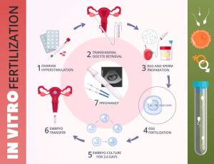 ivf treatment