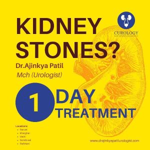 Kidney Stone Removal