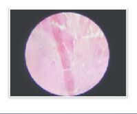 Diclofenac Sodium