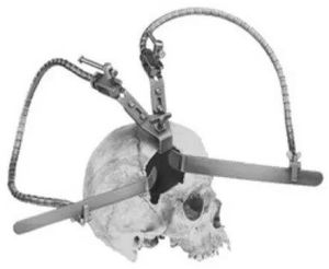 brain retractor