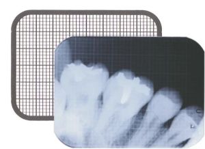 Dental Xray Grid