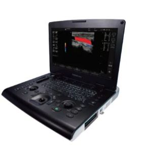 3D/ 4D GE Versana Active Ultrasound Machine