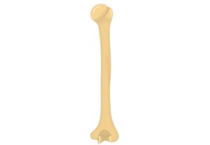 humerus nail