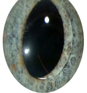 intraocular lens