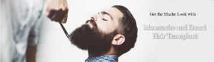 Beard Hair Transplant