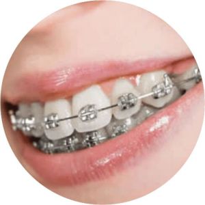 orthodontic treatment services