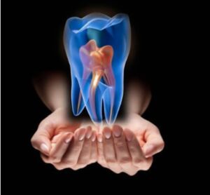 root canal treatment services
