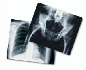 X Ray Films