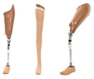 Above Knee Prosthesis