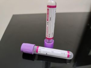 non vacuum blood collection tube