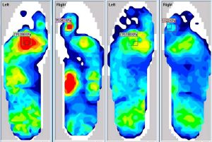 Foot scanning