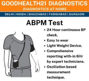 abpm test service