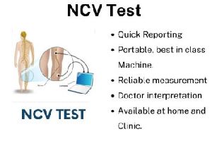 NCV Test Service