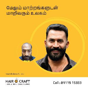 Hair Transplantation