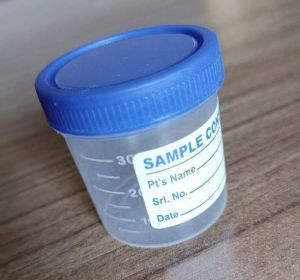 Urine Sample Container