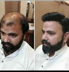 Hair Fixing Services