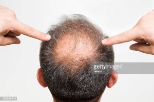 Hair Fixing Services