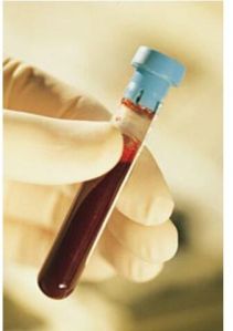 Blood Sugar Test Tube