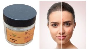 Pimples Face Pack