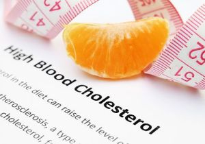 Cholesterol Diet Consultation Service