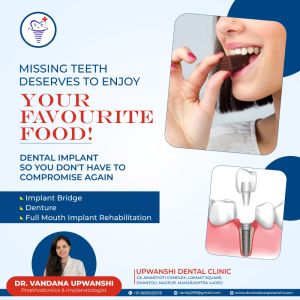 dental implant service