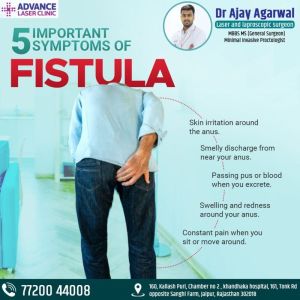 Fistula Treatment