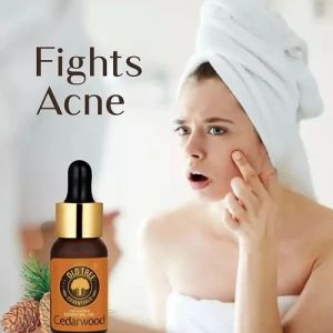 Cedarwood Essential Oil