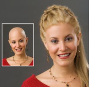 Cancer Patient Hair Wig Services