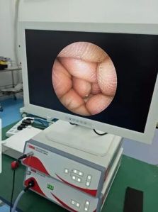 surgical camera