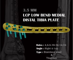 Lcp Medial Distal Tibia Plate