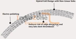 Everolimus Eluting Coronary Stent System