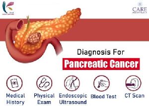 Pancreatic Cancer Treatment Services