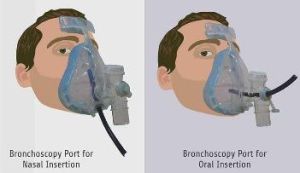 Bronchoscopy NIV Mask