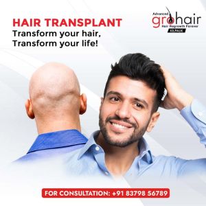 Hair Transplantation