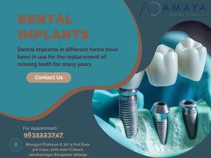 Dental Implants