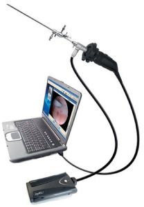 Office Hysteroscope Diagnostic System