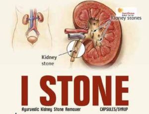 I-Stone Ayurvedic Capsules