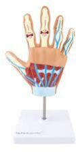 Hand Arthritis Model