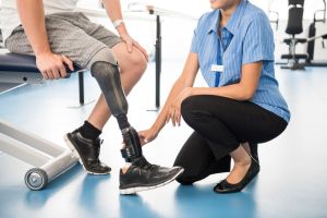 BELOW KNEE ARTIFICIAL LIMBS