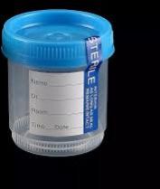 Urine Container 30 ml