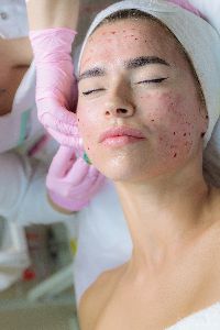 acne treatment services