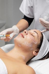 Chemical Peel