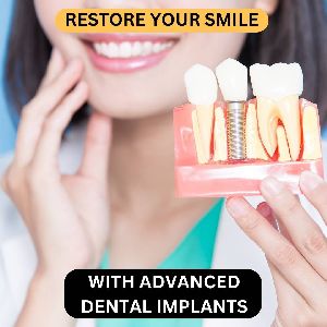 Dental Implants