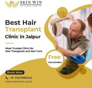 hair fall treatment