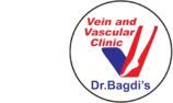 varicose veins treatment