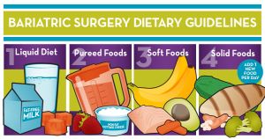 Bariatric Surgery Diet