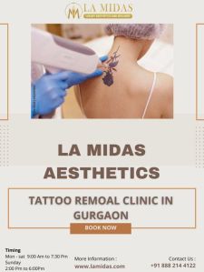 Laser Tattoo Removal Treatment