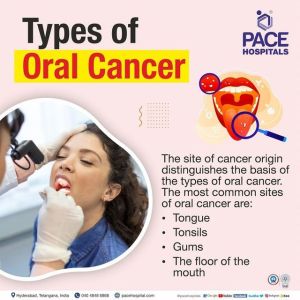 Oral Cancer Treatment